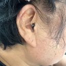 박진우 보청기·윤소희 청각재활센터 광주점 | 광주보청기 1년 넘게 꾸준히 관리받는 [박진우보청기윤소희청각센터 광주점] 후기
