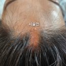 채움뷰띠끄