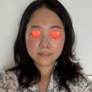 헤아림한의원 | 여름철 피부열감·홍조·진정템! 스킨시딘 멀티 토닝마스크 내돈내산 후기