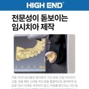 스마일라인 치과기공소 네이버블로그
