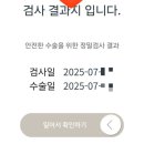 강남봄약국 | 투데이라섹 후기 1 - 강남 ㅇㅇㅅ 안과