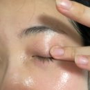 약국멍크림, 멍빨리빼는법! 디에스 에프터 올인원 케이 크림 사용 후기