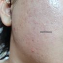 이성화한의원 | 아로마 테라피/양주도테라/의정부도테라/아로마 후기/테라피 피드백/도테라 라벤더/라벤더 오일/해독]