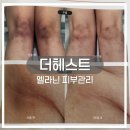 신안동1 | 광주 북구 신안동 피부관리 더헤스트 | 운암동 멜라닌 케어 후기