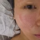 럭스에스테 | 홍대 윤곽관리 럭스에스테에서 받고 온 후기