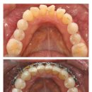 STL치과기공소 이미지