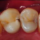 광진치과기공소 | 치과수면치료 믿을만한가요? 더서울치과에서 알려드립니다.