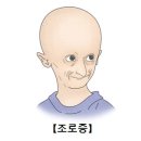 조로증[progeria]소아청소년질환, 유전질환 이미지