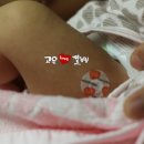 산후테리아
