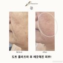 더스무스스킨케어&왁싱 네이버블로그