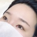 로얄클리닉센터 분당점 | 채비연래쉬 시그니처 클리닉펌 + 블랙틴팅 후기