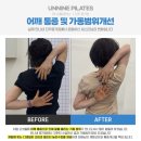 오승빌딩 | 어깨 통증 원인과 개선