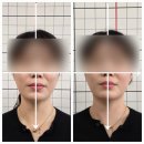 |부산 대연동 리턴바디 체형교정| 대연동 안면비대칭 교정관리 주2회 3주 후기