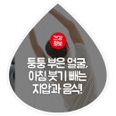 퉁퉁 부은 얼굴, 아침 붓기 빼는 지압과 음식! 이미지