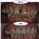 동의치과기공소 이미지