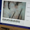 웰킨마포점 | 마곡 두피케어 추천! 웰킨두피탈모센터 마곡점 방문 후기