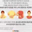 C형간염 증상 및 치료 전염 이미지