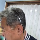 맑음보청기 네이버블로그