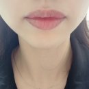 송도 르미에르 입술반영구 드디어 해본 내돈내산 후기