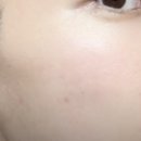 미라클케어 이미지