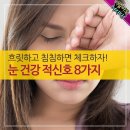 흐릿하고 침침하면 체크하자! 눈 건강 적신호 8가지 이미지