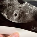 파주보건소 문산보건과 | 문산보건소 임산부등록, 초음파진료