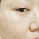 유산균에센스추천 큐라씨온 락토케어 베리어 에센스 사용 후기