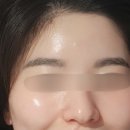 월평동산성 | 글로우잇필(애씨큘필) 내돈내산 후기 월평동 맞춤 피부관리는 [제이니샵]