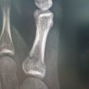 인스타 일반인 모델 다이어트 체험단 700만원 날리고 실패한 후기