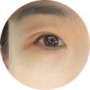 유안과의원 네이버블로그