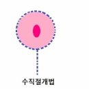 미큐의원 네이버블로그