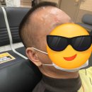 까끄리 | 아빠 백내장 수술 했어요! 👍 밝은안과21병원 후기