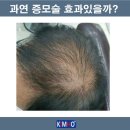 김호증모가발탐나
