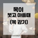 목이 붓고 아플때 (목감기) 이미지