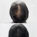 미송피부관리엔왁싱