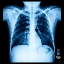 망포세우린한의원 이미지