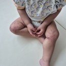 엄지어린이집 | 공포의 수족구 후기(14개월, 어린이집 적응기간)