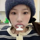무삭제 라미네이트 내돈내산 상담 솔직 후기 (치과 선택, 비용, 잇몸 성형까지)