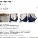 강남언니 어플, 가슴성형 후기/이벤트? 너무 눈여겨 보진 마세요.