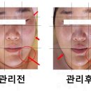 보떼드민