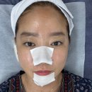 라비드에스테틱 | 김포 피부관리 내돈내산 천방케어 받고 1주일 후 리버스 하이드라 케어까지 받아본 후기