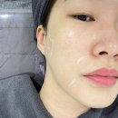일산 피부과 슈링크 유니버스 300샷 내돈내산 후기