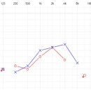 광주 보청기 이미지