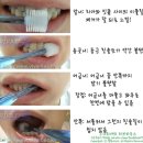 시그마덴탈 네이버블로그