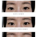 세인성형외과 이미지