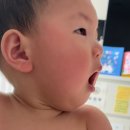 9개월 아기 고열, 명지병원 응급실 진료, 원흥아이제일병원 검사 치료 후기 (feat. 4번방, 7번방)
