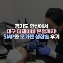 경기도 안산에서 대구 더제이비 본점까지! SMP와 모가젠 생장술 후기