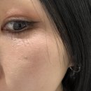 광 | 용산 한남동 피부과 셀르디엠 후기 3주차(모공,결,광 후기)