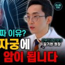 생리인 줄 알았습니다 폐경 후 피가 비친다면 자궁내막암을 의심해야 하는 이유 이미지