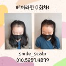 스마일헤어라인